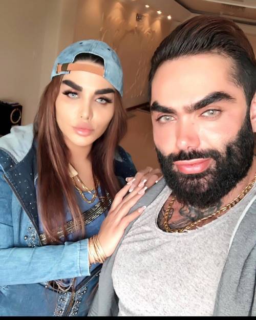 پرستش عربلو قبل عمل زیبایی