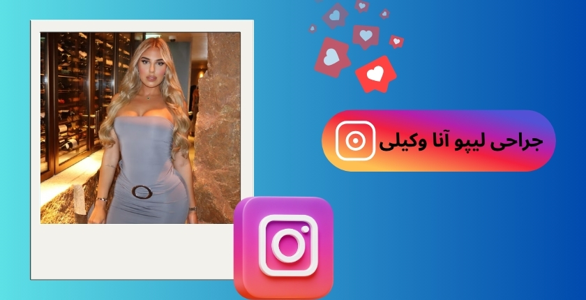 جراحی لیپو آنا وکیلی